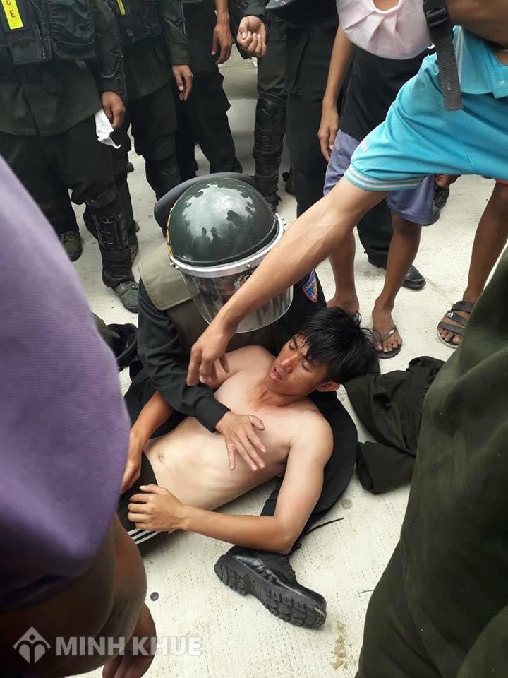 Xác định tỷ lệ thương tật và trách nhiệm hình sự khi uống rượu say đấm người khác mù mắt ?