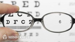 Những câu hỏi thường gặp về tật khúc xạ (cận thị, viễn thị, loạn thị) có phải đi nghĩa vụ quân sự hay không ?