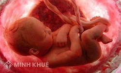 Chế độ thai sản áp dụng khi thai chết lưu theo quy định mới nhất