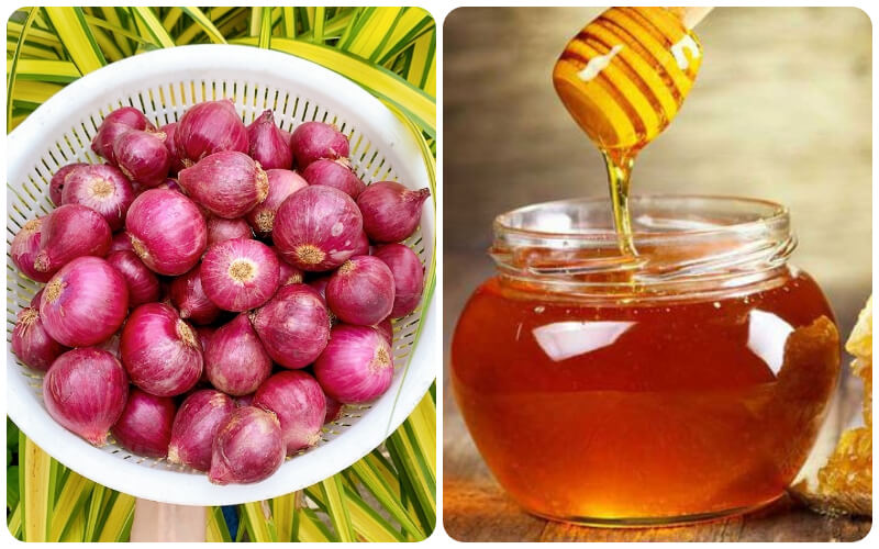 Tổng hợp các cách trị ho tại nhà bằng phương pháp tự nhiên