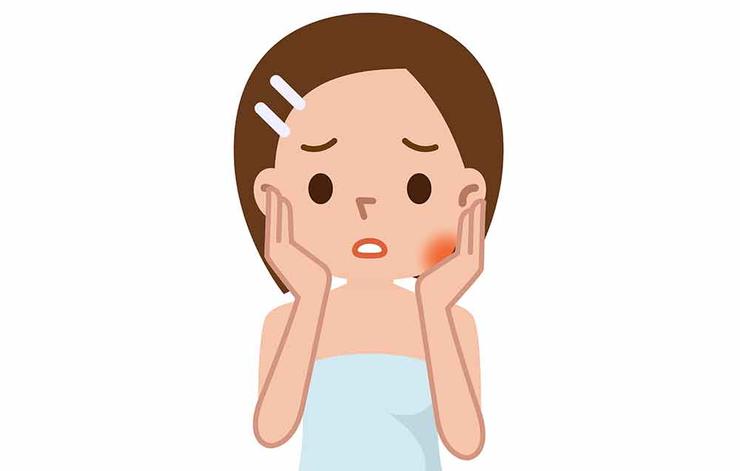 Một số lý do khiến khuôn mặt của bạn sưng phù