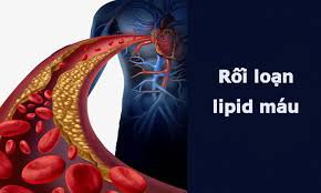 Bệnh rối loạn chuyển hóa lipid máu là căn bệnh như thế nào?
