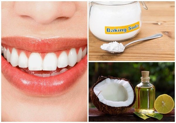 Cách trị đốm đen trên răng tại nhà
