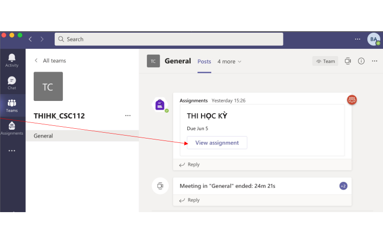 MS tracking là gì? Cách sử dụng MS tracking thi online