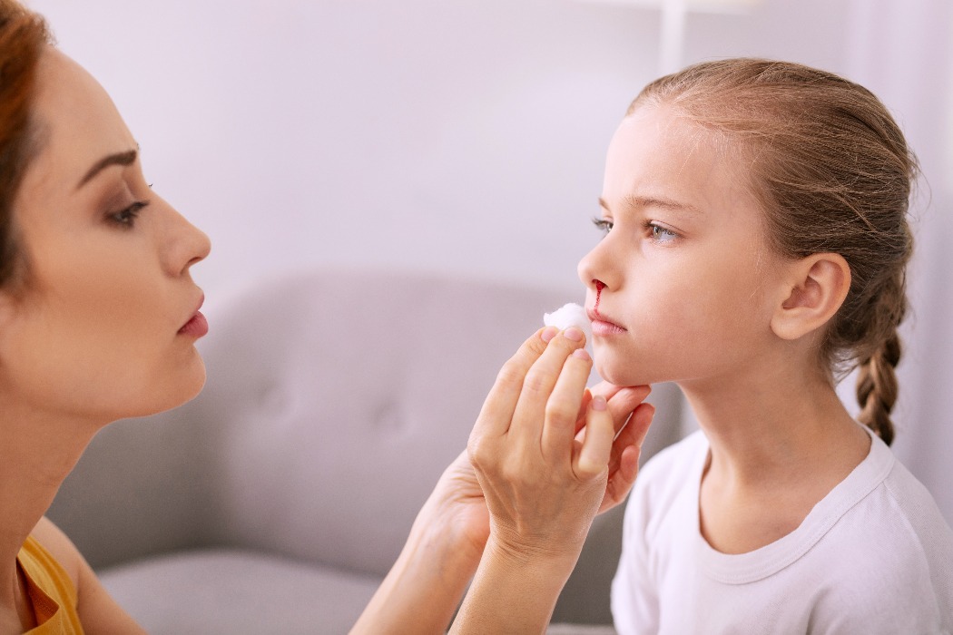 Có phải cứ chảy máu cam là do thiếu chất?