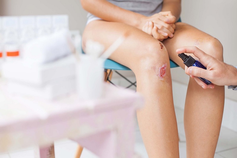 Khi bị vết thương hở nên ăn gì và không nên ăn gì?