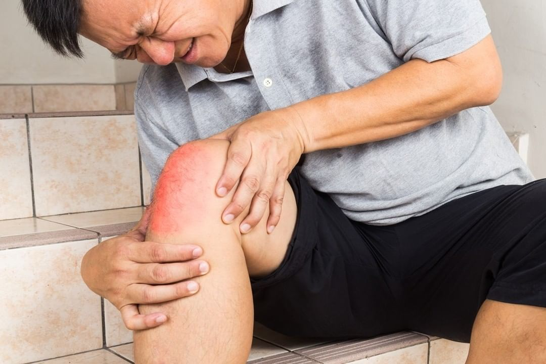 Nên ăn gì và kiêng gì khí bị tràn dịch khớp gối
