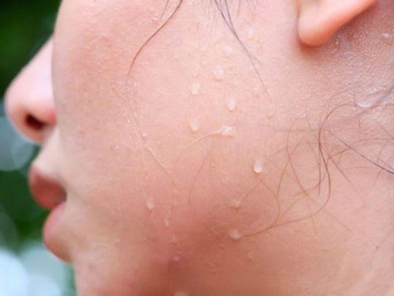 Mồ hôi muối và mồ hôi dầu là gì? Cách khắc phục tình trạng mồ hôi muối