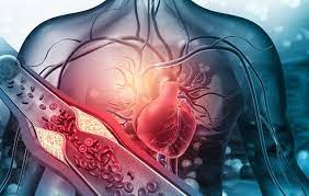 Cholesterol là gì? Tất tần tật những điều cần biết về Cholesterol
