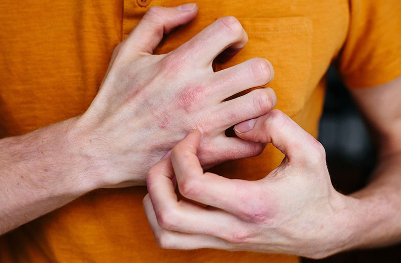 Nguyên nhân gây ngứa ran ở tay và chân