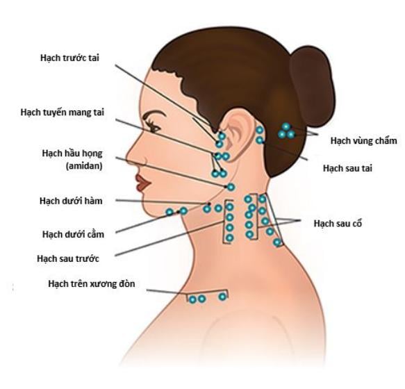 Hạch nổi sau cổ, gáy có đáng lo không ?