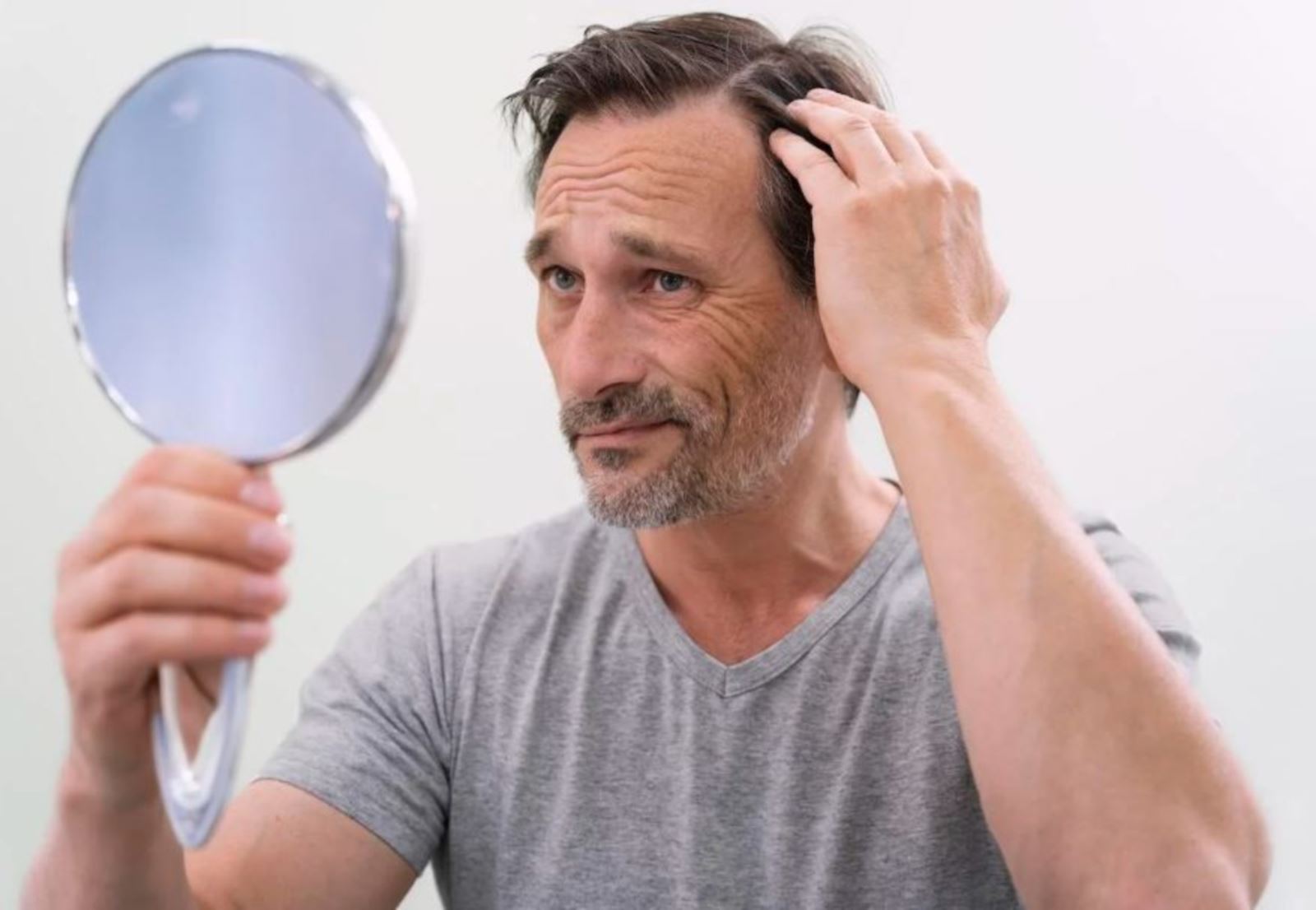 Hormone Dihydrotestosterone là gì? DHT và chứng rụng tóc ở nam giới