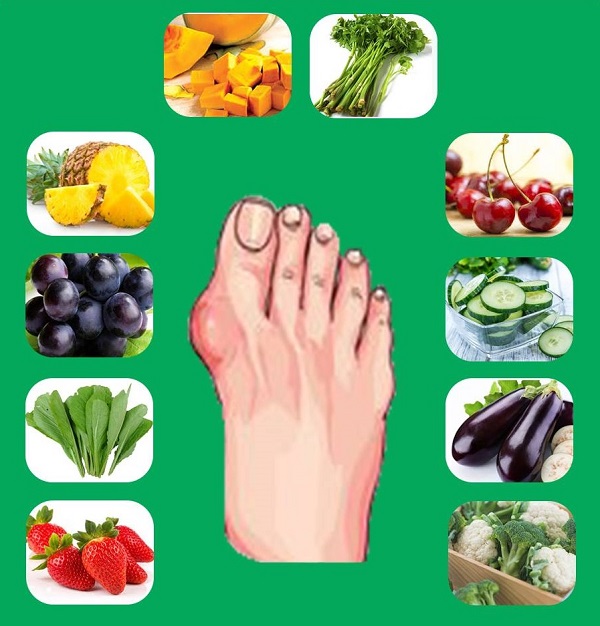 Bệnh nhân Gout nên biết về hàm lượng purin trong các loại thức ăn