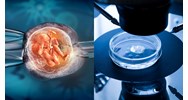 Ai có thể đề nghị thực hiện kỹ thuật thụ tinh trong ống nghiệm?