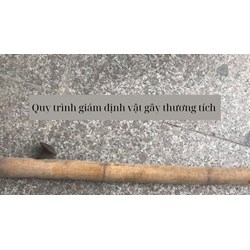 Quy trình giám định vật gây thương tích
