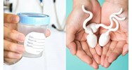 Độ tuổi của người hiến tinh trùng, họ có được bảo mật thông tin?