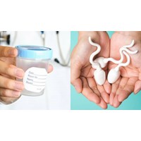 Độ tuổi của người hiến tinh trùng, họ có được bảo mật thông tin?