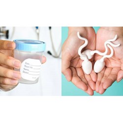 Độ tuổi của người hiến tinh trùng, họ có được bảo mật thông tin?