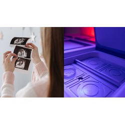 Nữ dưới 18 tuổi được nhận tinh trùng để thụ tinh trong ống nghiệm?