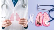 Các nguyên tắc trong việc điều trị bệnh lao phổi kháng thuốc?