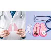 Các nguyên tắc trong việc điều trị bệnh lao phổi kháng thuốc?