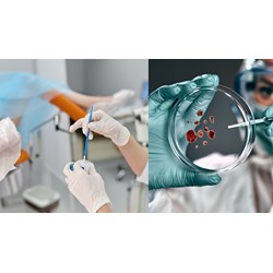 Phương pháp thử với cấy ghép vật liệu sinh học dự định sử dụng