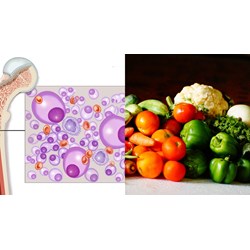 Chế độ dinh dưỡng cho người bệnh đa u tuỷ xương như thế nào?