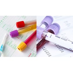 Quy trình xét nghiệm nồng độ cồn người điều khiển xe ô tô bị tai nạn