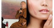 Cách chữa lành vết thương tâm lý sau biến cố