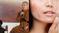 Cách chữa lành vết thương tâm lý sau biến cố
