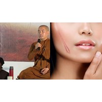 Cách chữa lành vết thương tâm lý sau biến cố
