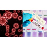 Thông báo kết quả xét nghiệm HIV phải được thực hiện chậm nhất 72 giờ làm việc