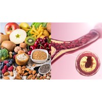 Mách bạn các loại thực phẩm có thể giúp ngăn ngừa tắc động mạch