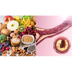Mách bạn các loại thực phẩm có thể giúp ngăn ngừa tắc động mạch