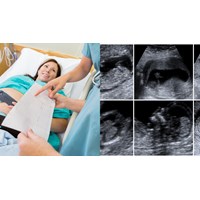 Phổ biến phương pháp để có được giới tính thai nhi theo ý muốn có vi phạm?