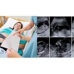 Phổ biến phương pháp để có được giới tính thai nhi theo ý muốn có vi phạm?