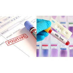 Kê đơn cho người đã điều trị thuốc kháng HIV 12 tháng trở lên nhưng chưa ổn định?