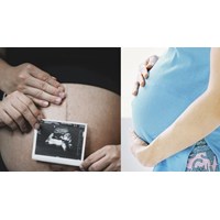 Thai nhi trong bụng có được coi là người có năng lực pháp luật dân sự?