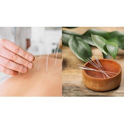 Cách thức hoạt động, lợi ích và kết quả giảm đau của châm cứu