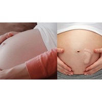 Những trường hợp nào phụ nữ mang thai được phép nạo phá thai?