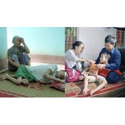 Con của người nhiễm chất độc da cam có được tạm hoãn nghĩa vụ quân sự