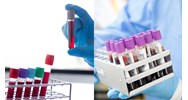 Phương phát phát hiện xyanua trong rượu chưng cất không chứa SO2?
