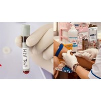 Quy trình quản lý thông tin người được xét nghiệm HIV dương tính