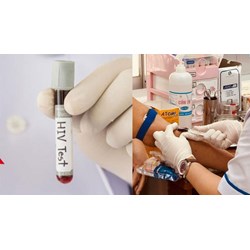 Quy trình quản lý thông tin người được xét nghiệm HIV dương tính