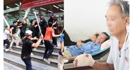 Vô cớ bị hành hung phải nhập viện được bồi thường ra sao?