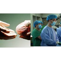 Điều kiện phải đảm bảo với cơ sở y tế ghép bộ phận cơ thể người?