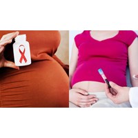 Trường hợp phụ nữ mang thai tại cơ sở y tế được chỉ định xét nghiệm HIV