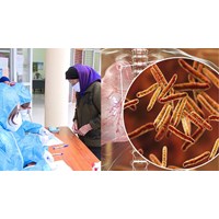 Nguyên tắc phối hợp giữa các cơ sở y tế trong quản lý bệnh lao