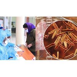 Nguyên tắc phối hợp giữa các cơ sở y tế trong quản lý bệnh lao