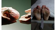 Quy định tôn vinh người hiến bộ phận cơ thể ở người sau khi chết, hiến xác